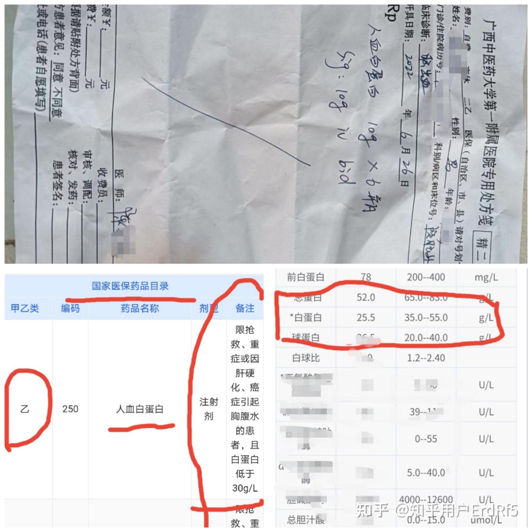 人血白蛋白处方单图图片