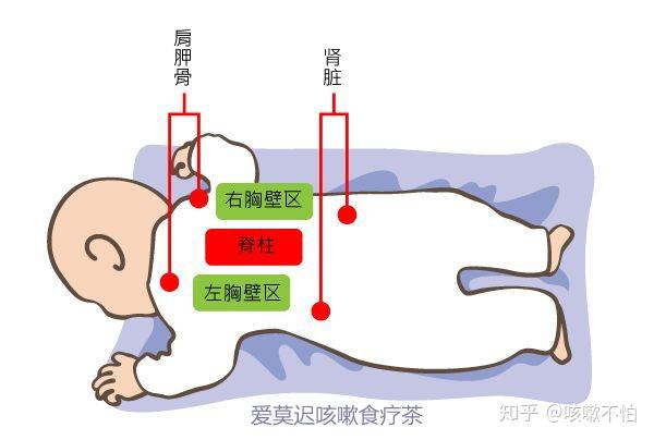 小儿婴儿宝宝小孩拍痰拍背排痰拍痰正确手法爱莫迟咳嗽食疗茶_腾讯