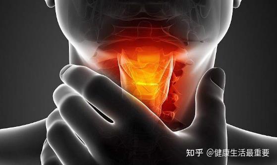 急性咽炎通常会在一周内自行缓解,但这些方法可以帮助缓解不适感 - 知乎