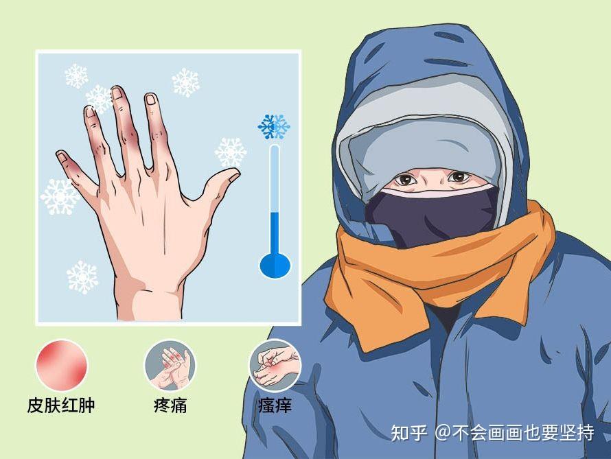 冻疮痒这么缓解 - 知乎