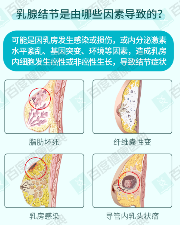 另外一個就是乳腺結節,許多女生在檢查出乳房有結節後,就非常害怕,總