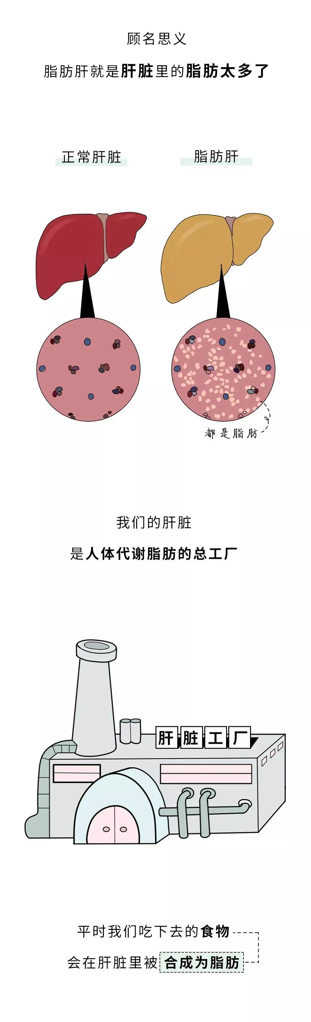 史上最有趣的"脂肪肝"科普漫画,值得收藏!