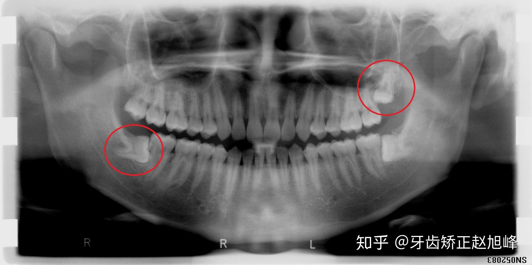 v2-6de7279e90e38cbda5b66fb391814061_r.jpg