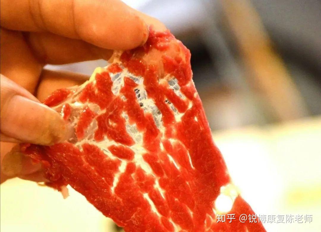 「锐博康复」筋膜到底是个啥?腰疼,腿疼,膝盖疼,竟然都和它有关!