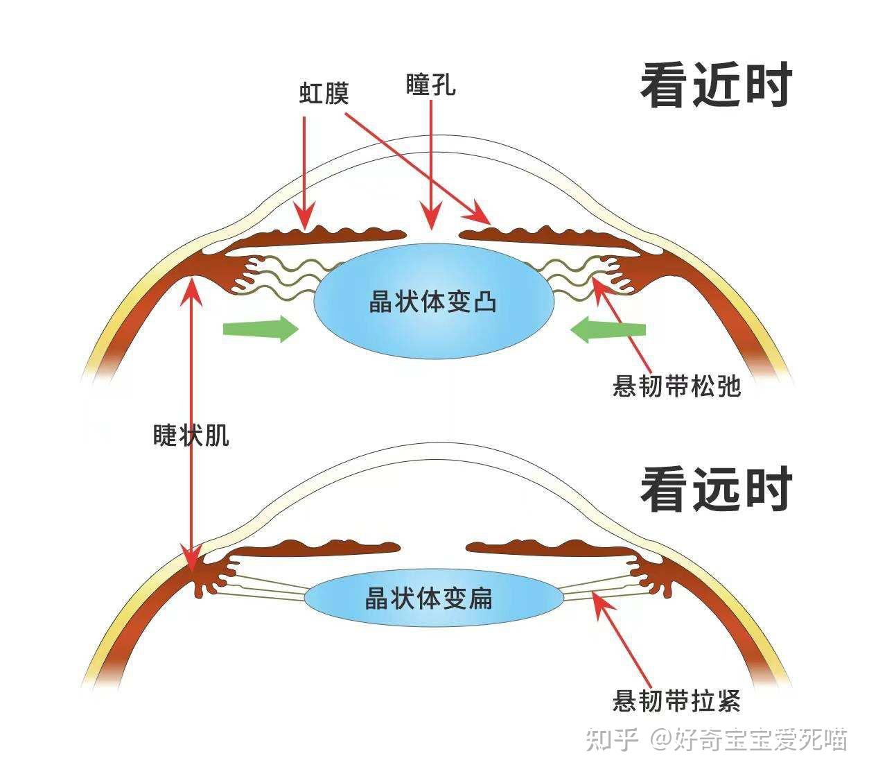 轴性近视的发展原理及如何预防