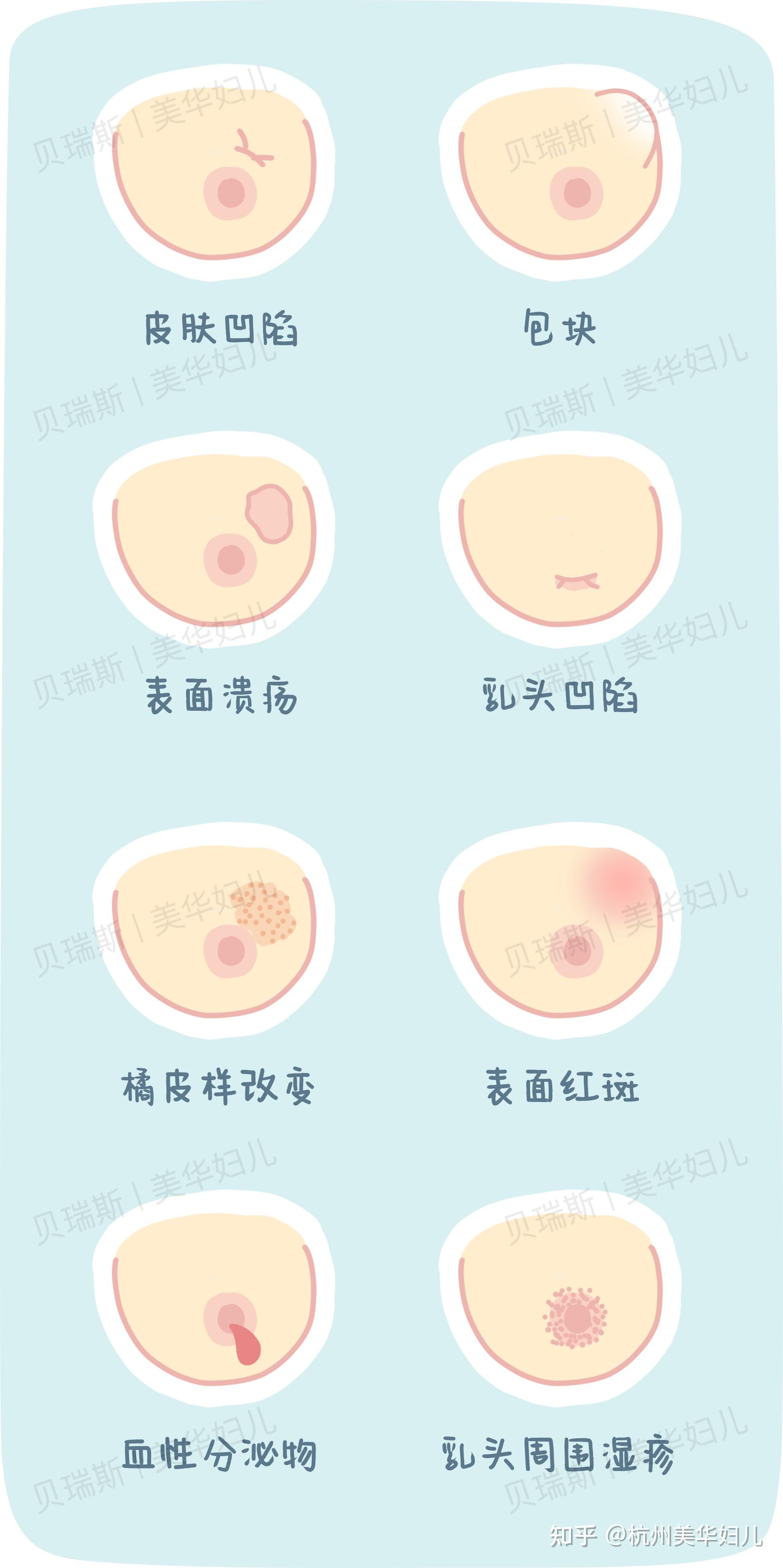 一张图教你「乳房自检」