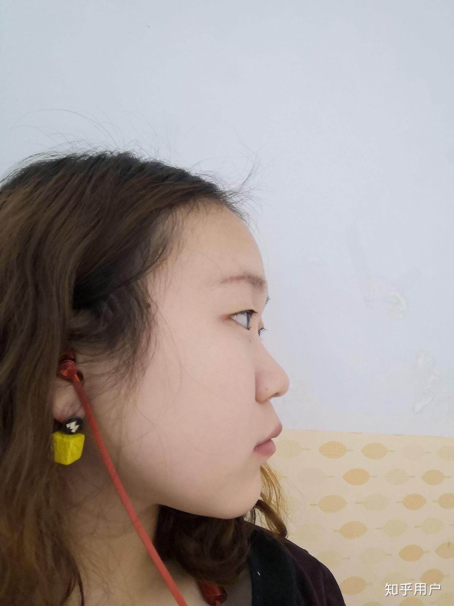 没有鼻梁鼻子塌的人是什么体验