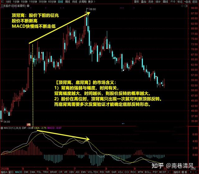 MACD的顶背离和底背离图解，轻松掌握股票买卖点！ - 知乎