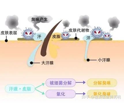 腋臭应该挂什么科 - 知乎