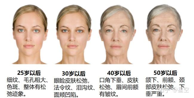 40岁以后的女性该如何延缓皮肤衰老