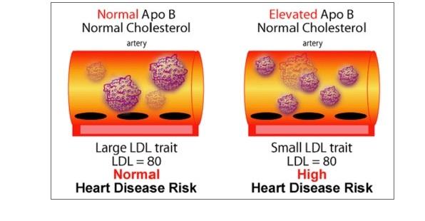 為什麼載脂蛋白 b 比低密度膽固醇 ldl 更重要?