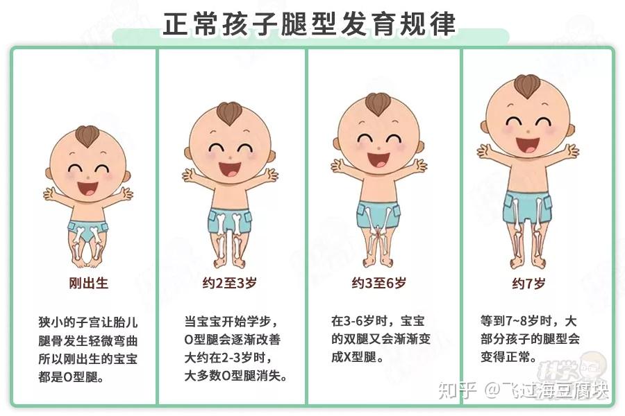 儿童腿型发育过程图图片