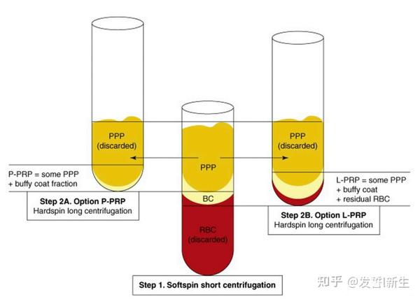 富血小板血浆,一种新兴的脱发治疗“神器”? - 知乎