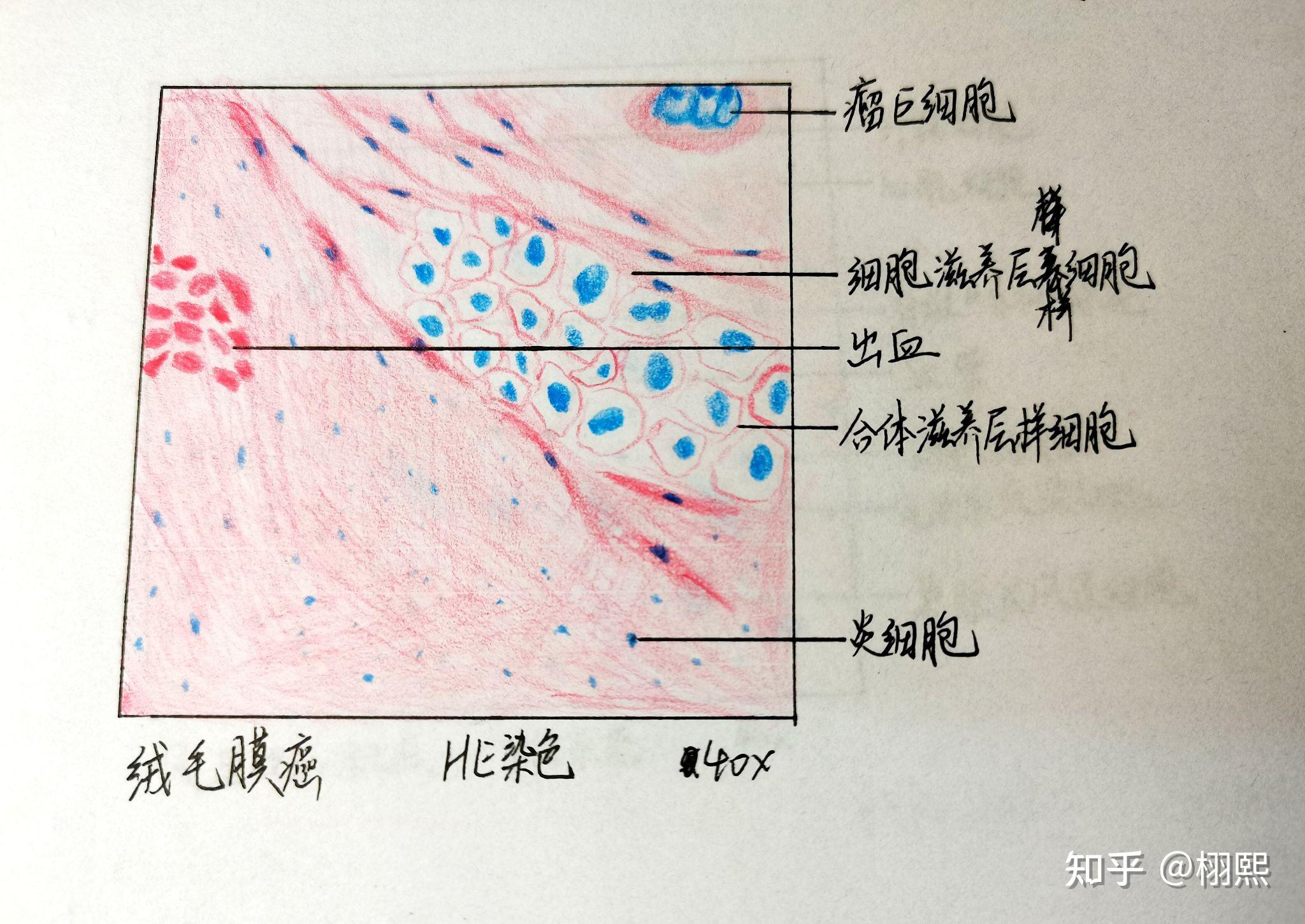 病理实验报告红蓝铅笔手绘图 