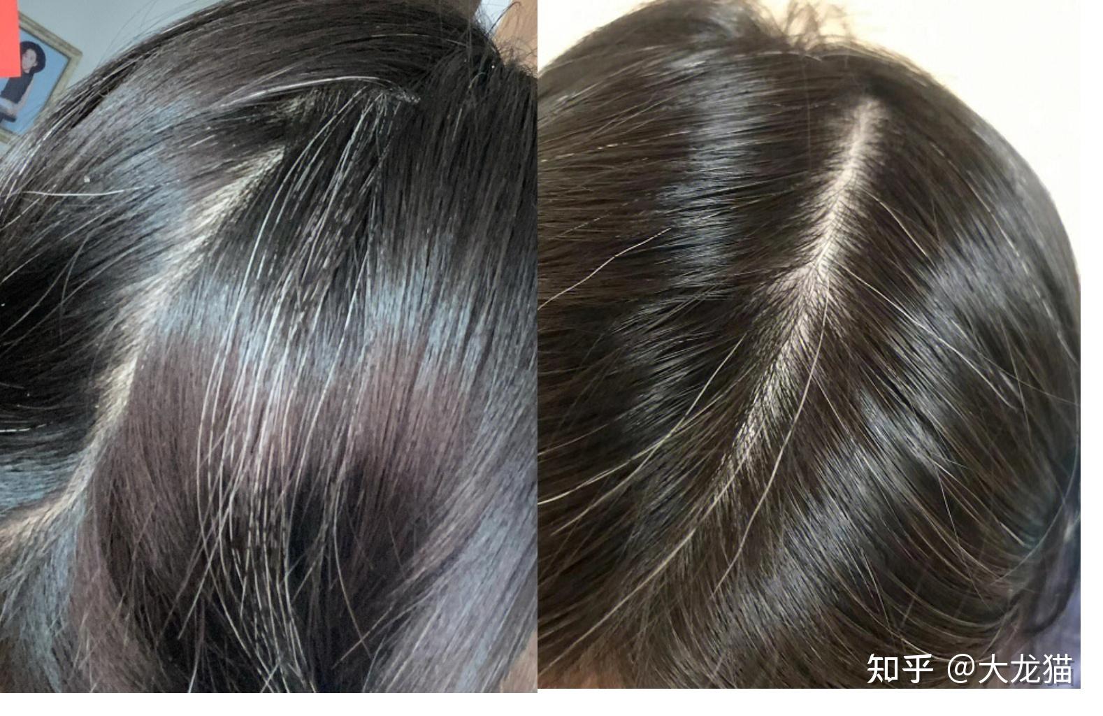 你们有用过哪些真正有用的白发转黑神器吗? - 知乎