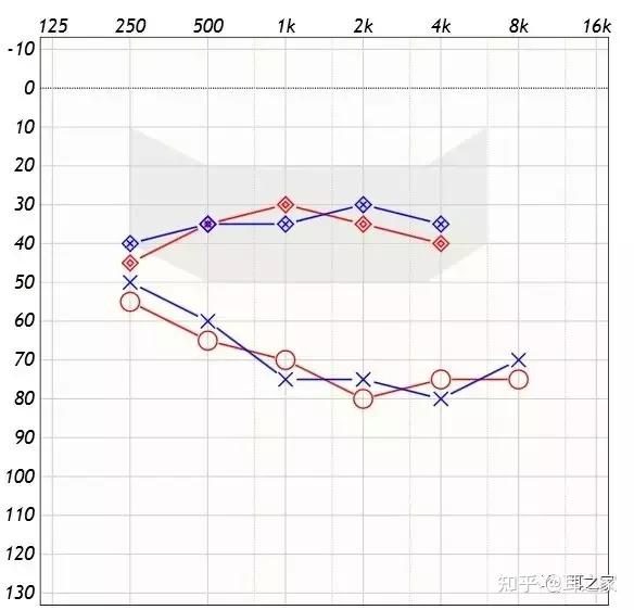 助听器效果评估—助听听阈 - 知乎