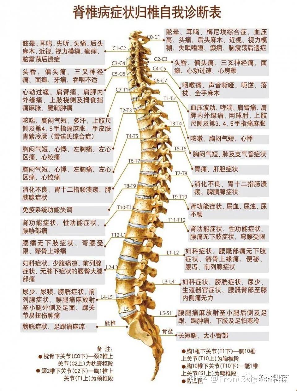 强直性脊柱炎片子图解图片