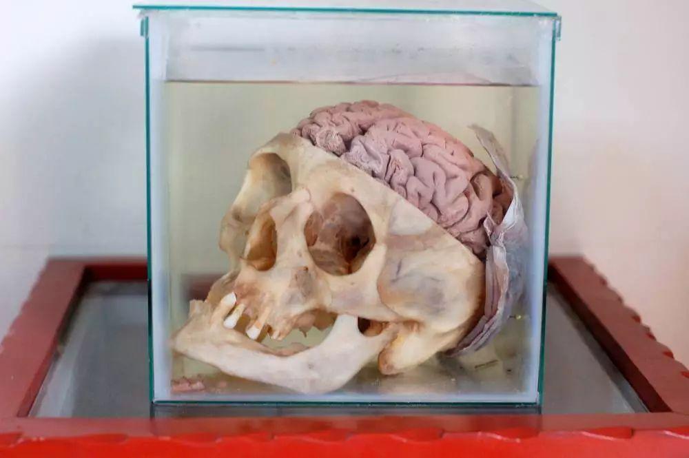 de mogrovejo hospital)内有一家大脑博物馆,收藏了近3000例大脑标本