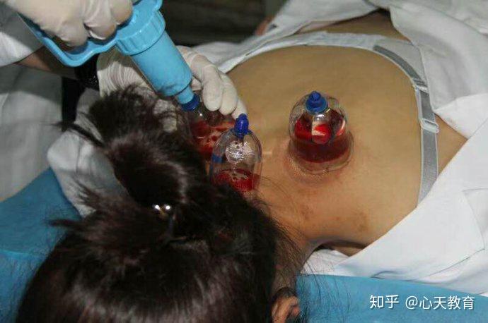 心天排瘀疗法高血压与颈椎病之间的小秘密