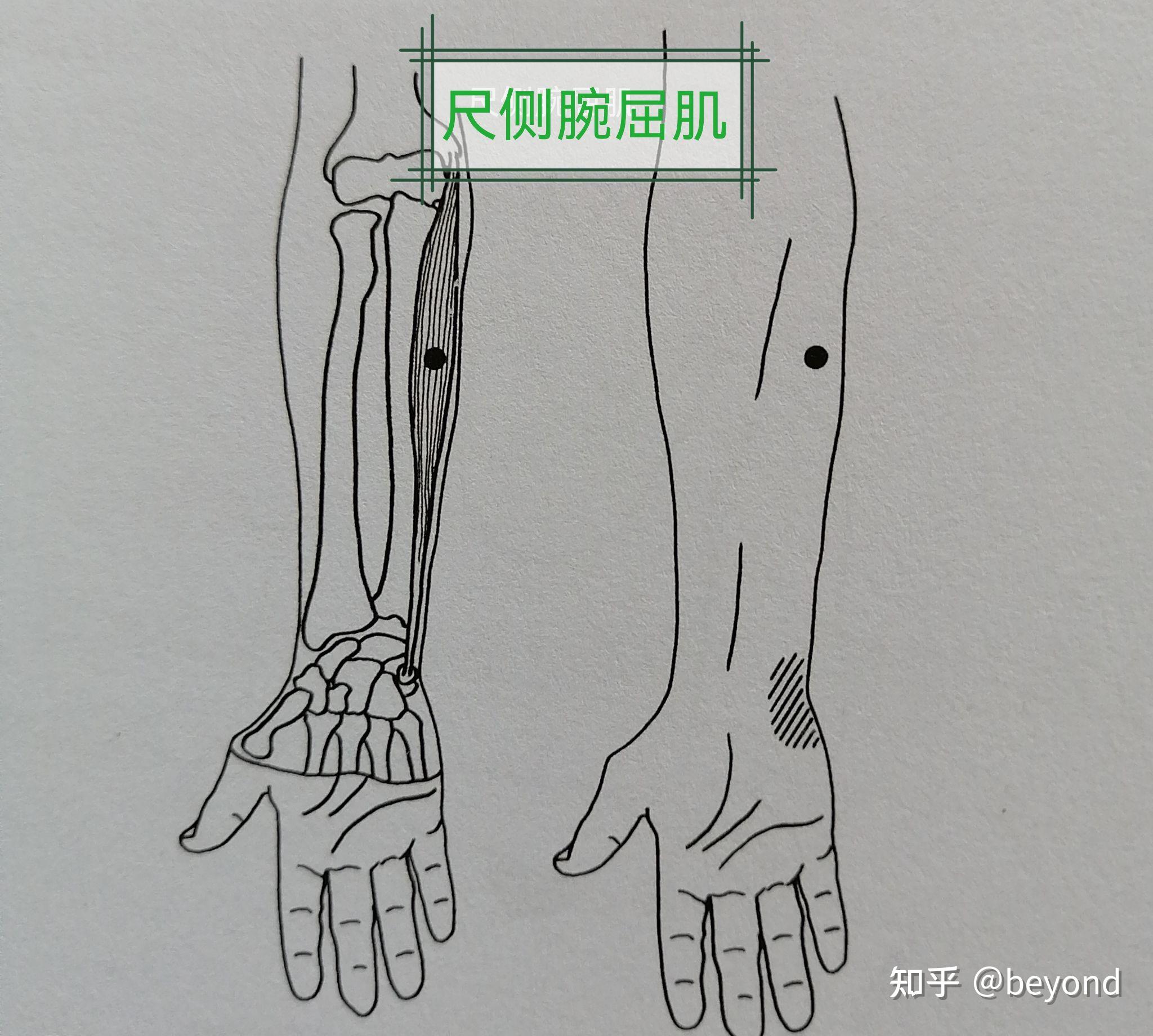 尺侧腕屈肌连接内上和豌豆骨