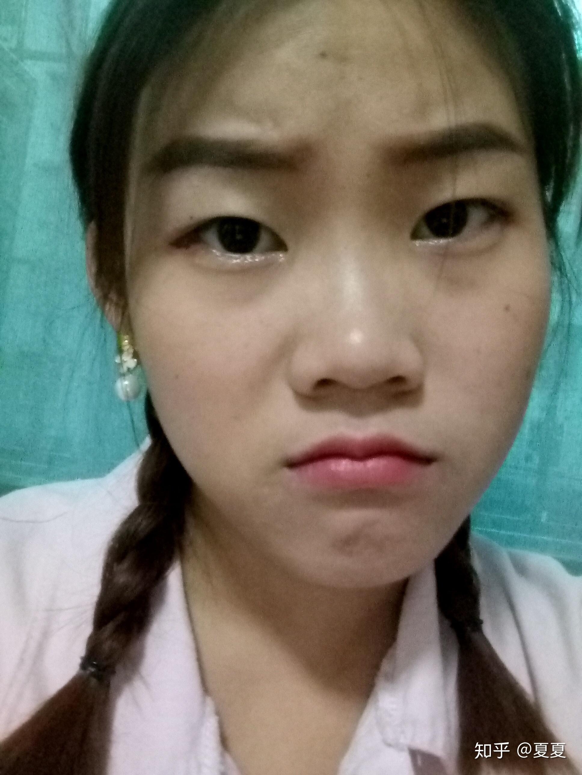 女生塌鼻子是种怎样的体验