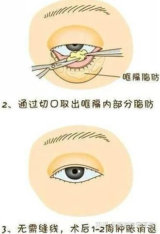 v2-6faf421219d8111e41dd55486b59b4b1_b.jpg