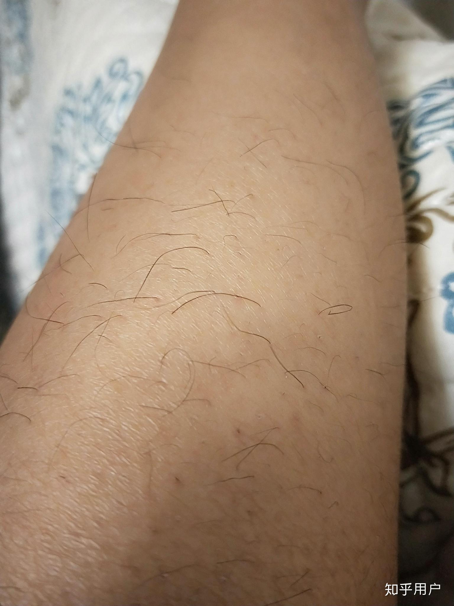 女生腿毛超多是一种什么样的体验
