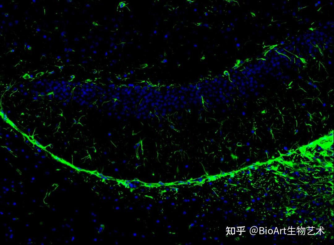 vimentin with rabbit anti-vimentin antibody(et1610-39 at 1/1