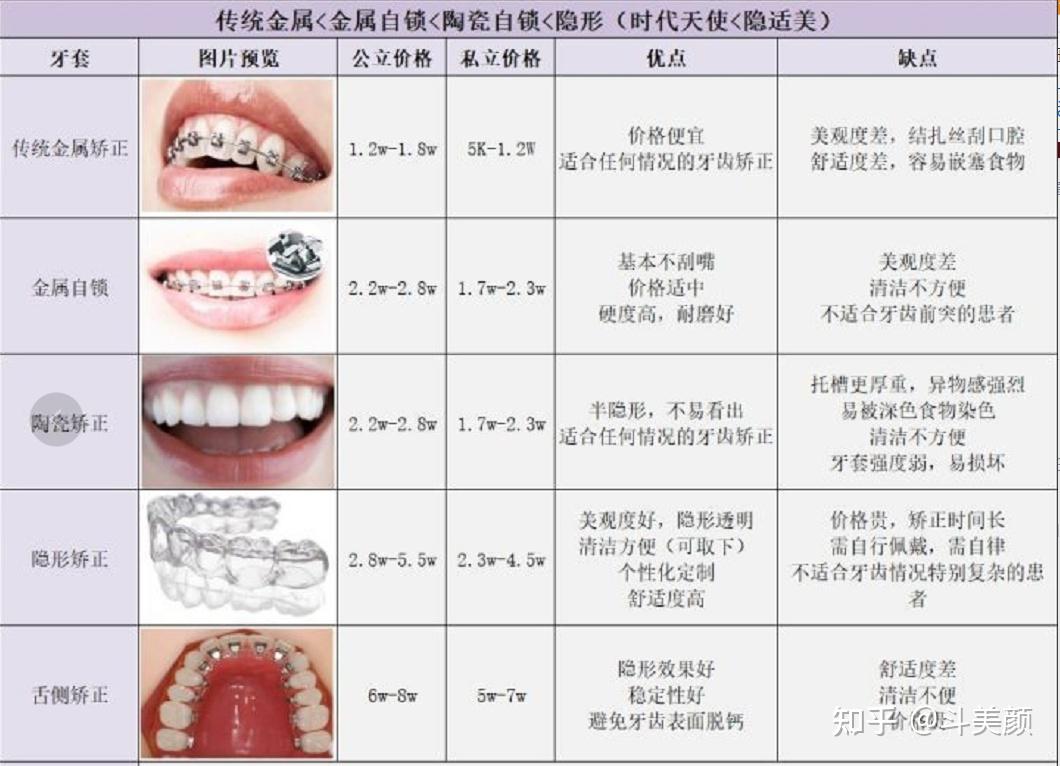 牙齿矫正价格是多少?矫牙公立私立医院医生怎么选?会有什么后遗症?整牙攻略全分享 - 知乎