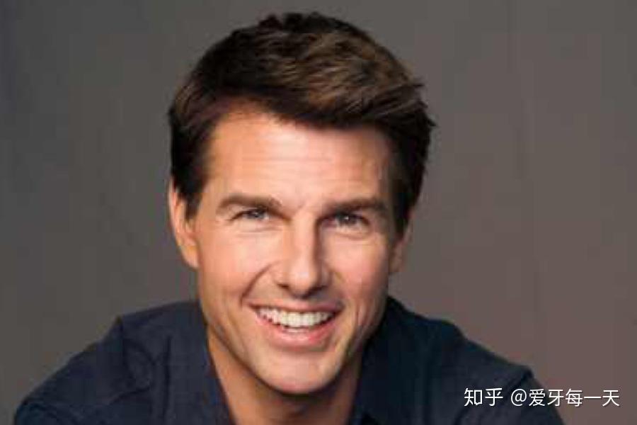 碟中谍6的阿汤哥告诉你牙该整就得整