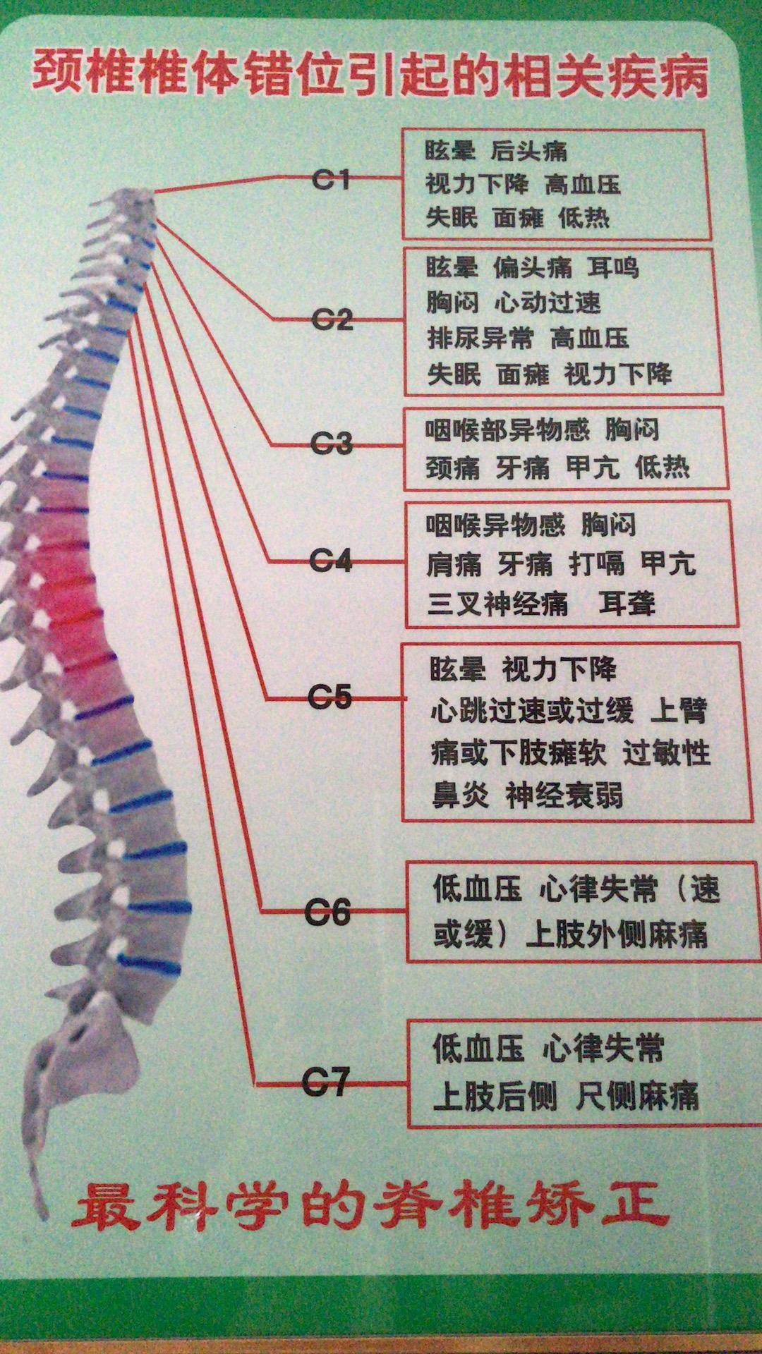 颈椎曲度变直反弓的原因危害