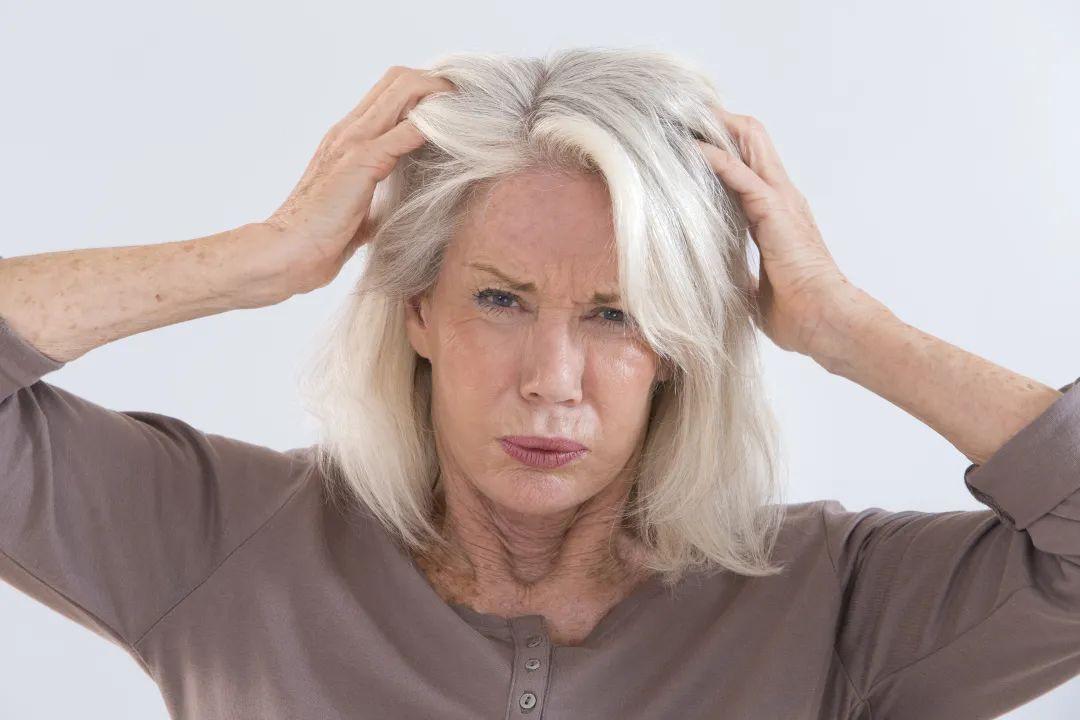 为什么压力大时会长白头发这些习惯可能会催生白发