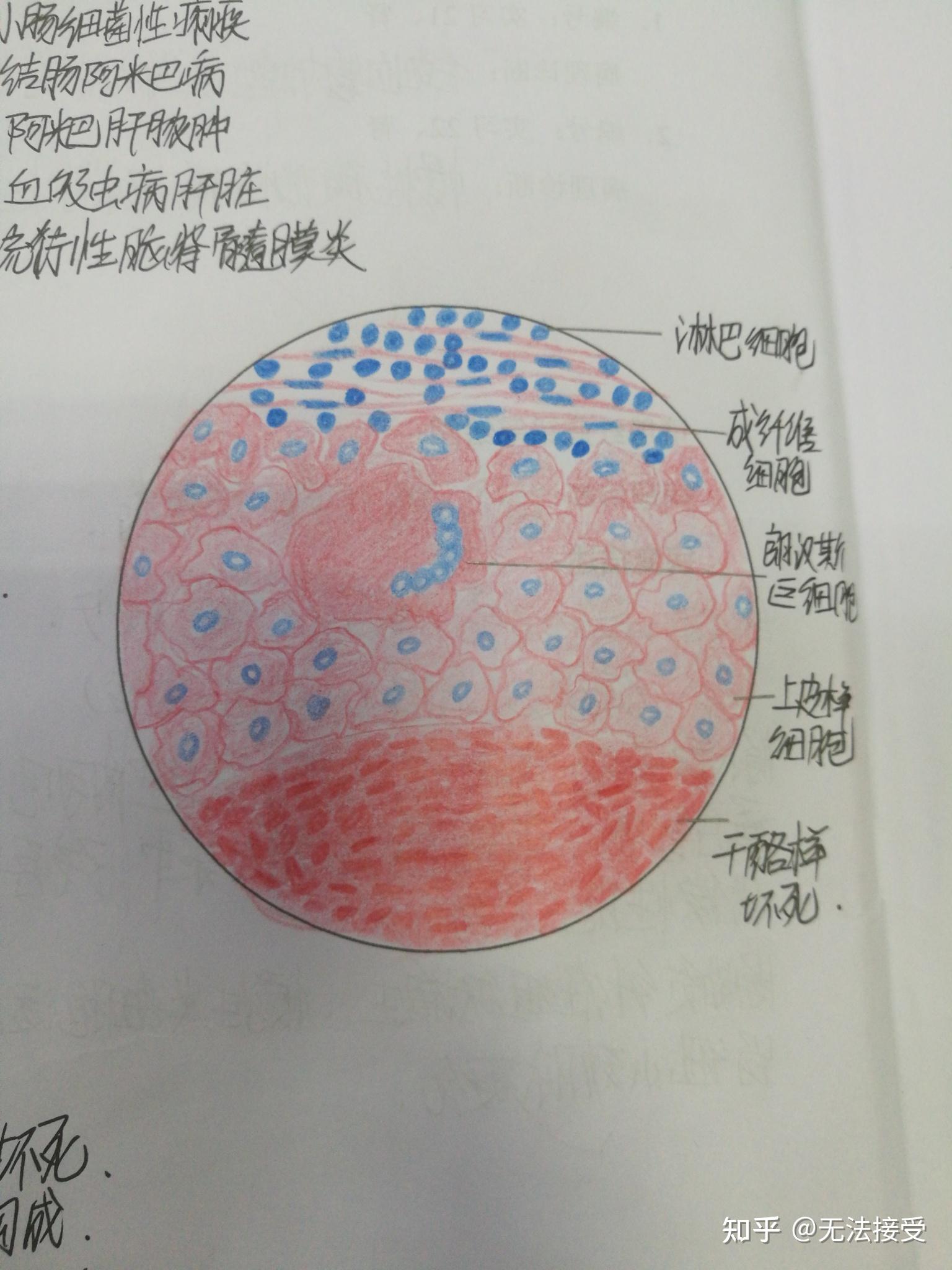 病理红蓝铅笔绘图