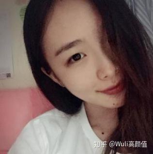 埋线双眼皮恢复全过程视频 v2-7072a866e72e5735868c2d83818ab17d_b.jpg