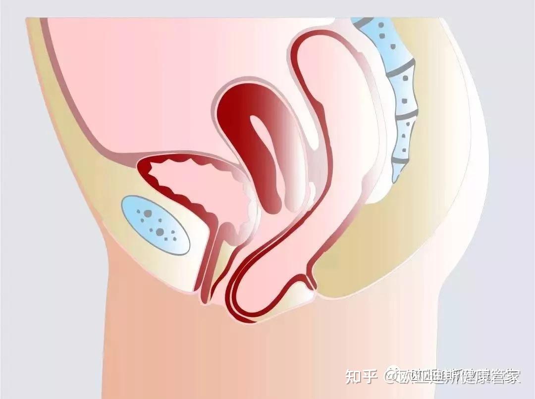 直肠膨出图片图片