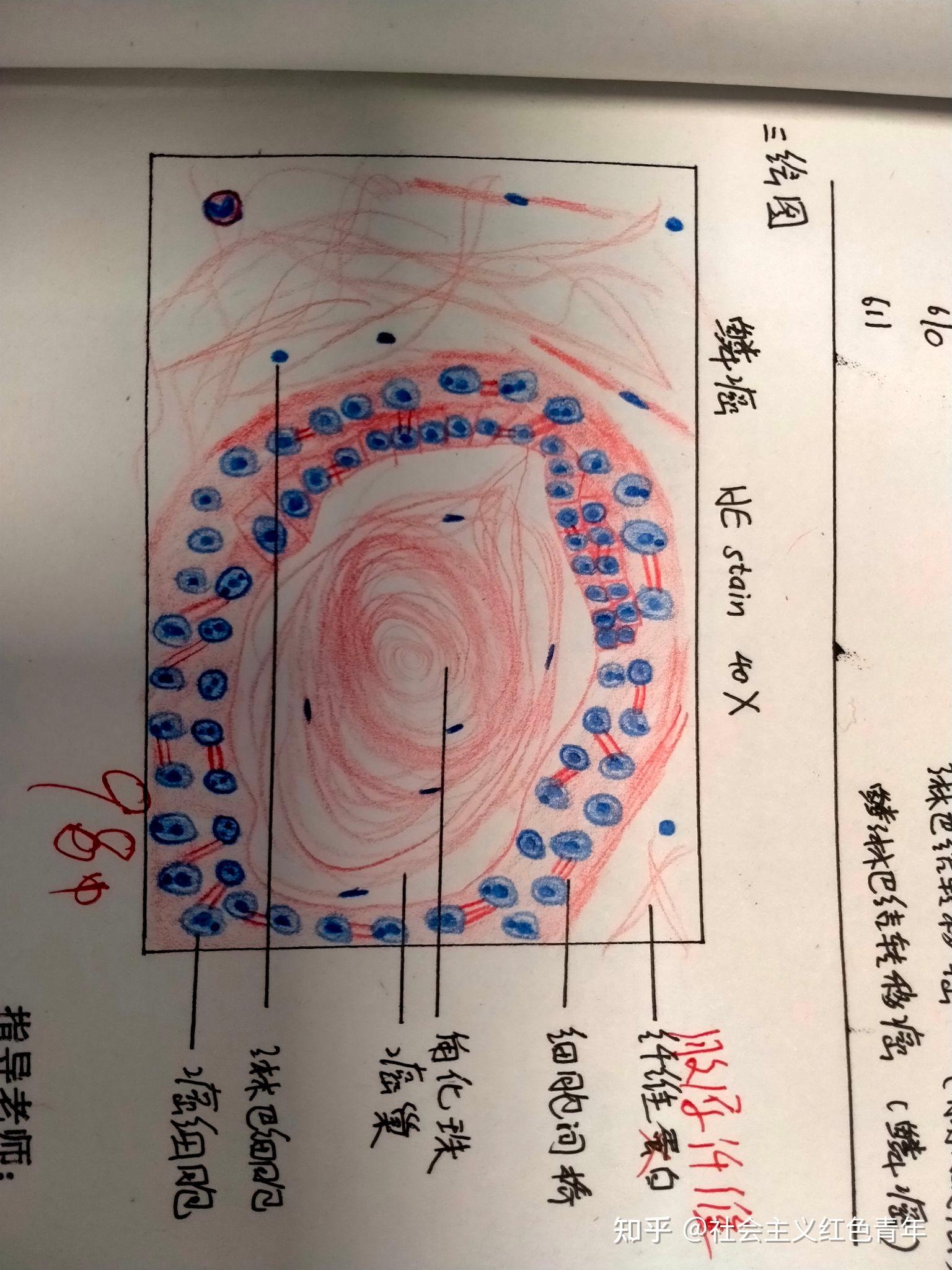 病理学红蓝铅笔绘图