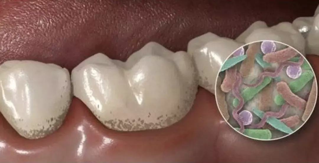 孩子小时候喝可乐,我总觉得孩子会换牙,等到以后再注意,等长大了,却没