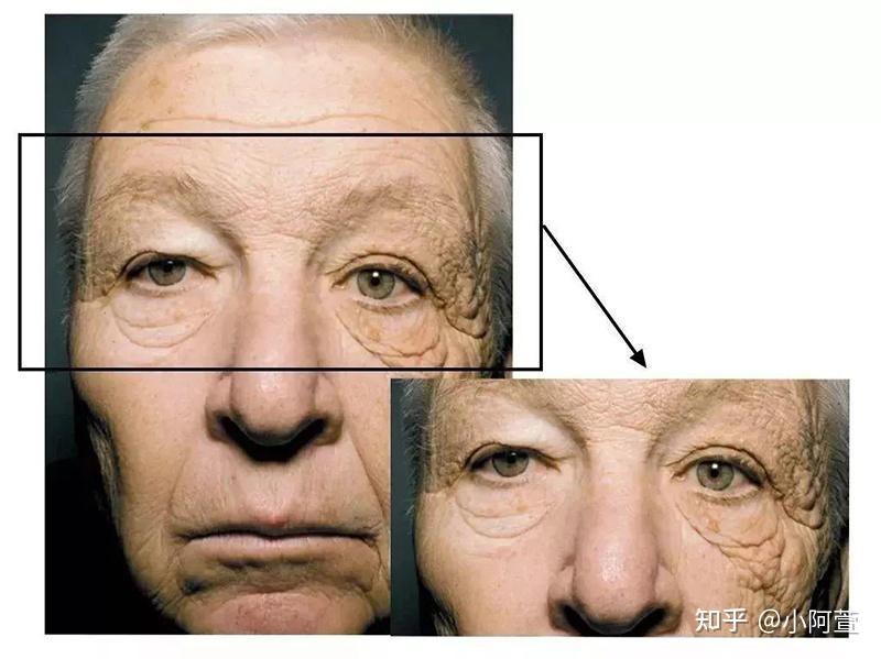 为什么认真护肤抗老没有效果? - 知乎
