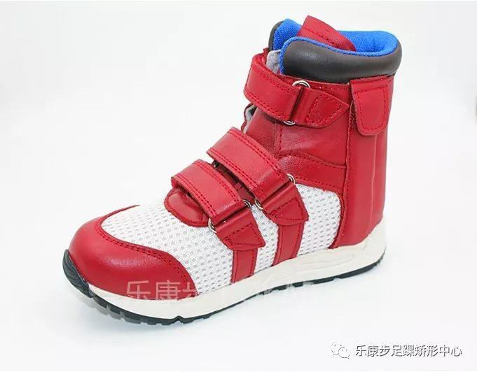 尖足矫正临床效果分析