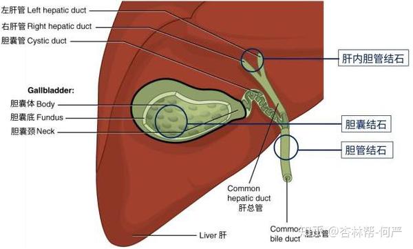 腹腔镜胆囊切除术适应症 术后注意事项有哪些 知乎