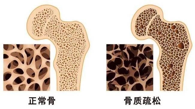 v2-710f55bafccba8c2376fb83330ad3561_1440w.jpg?source=172ae18b