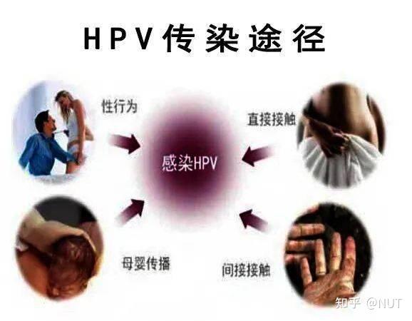 科学了解HPV——病毒疣 基层诊疗指南及浅析(含常见治疗方法) - 知乎
