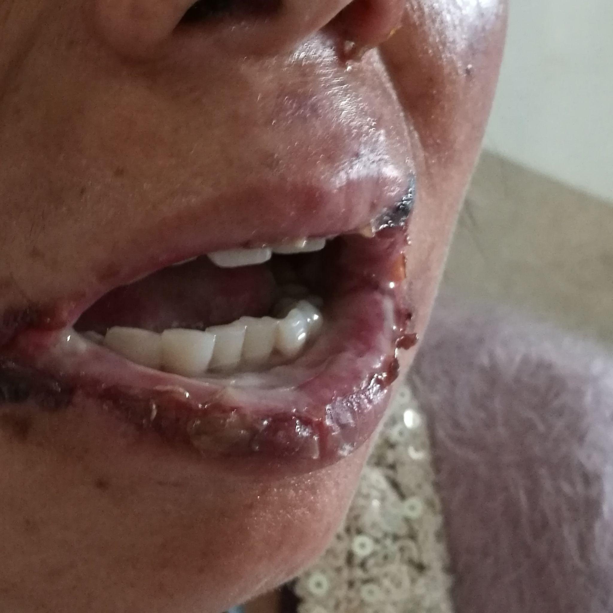 作为医生看见面前一个暂时活蹦乱跳的喝了百草枯的病人是怎样一种感觉