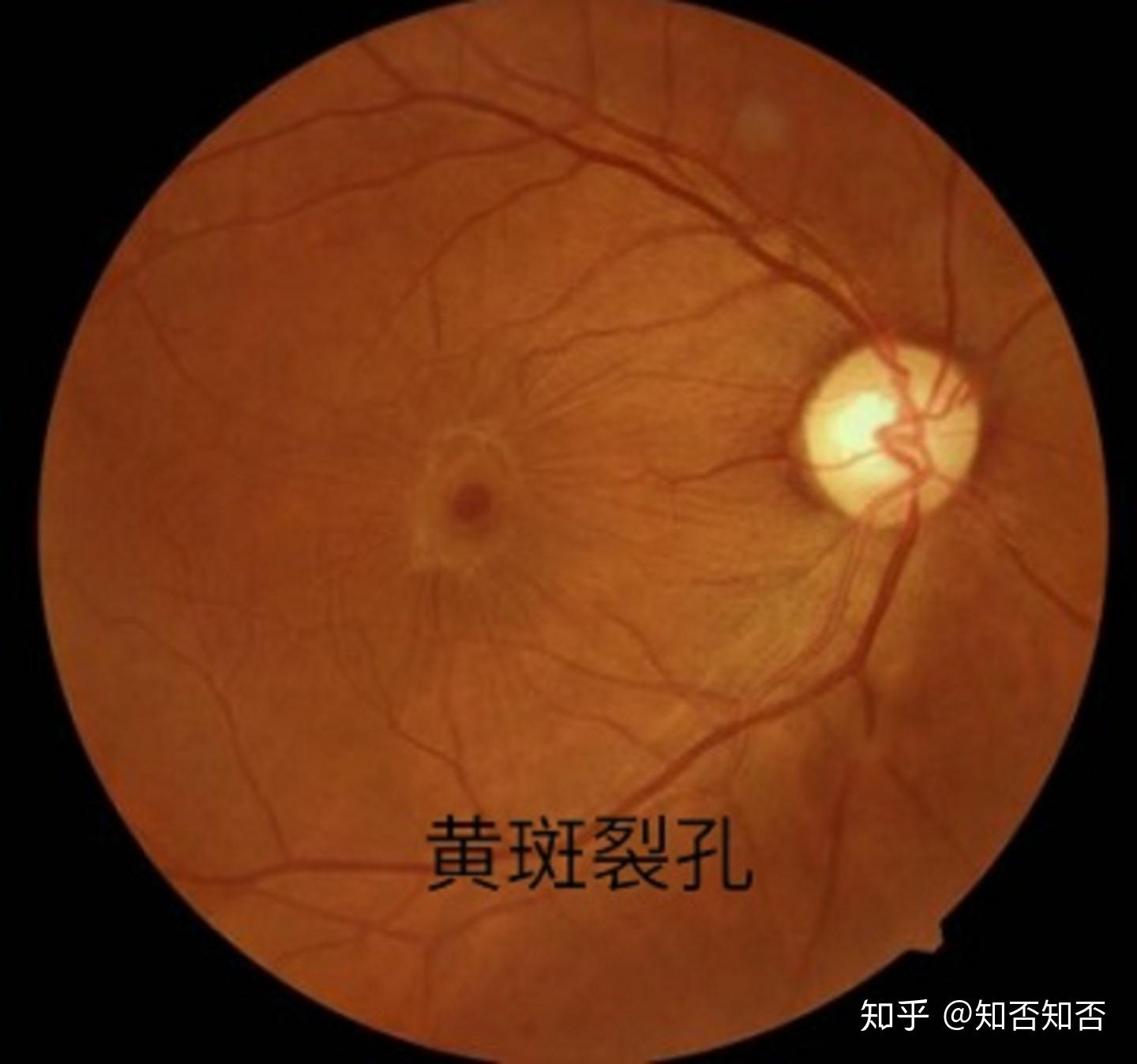 v2-7154664d227d603ee97a42ac8c3d808c_r.jpg