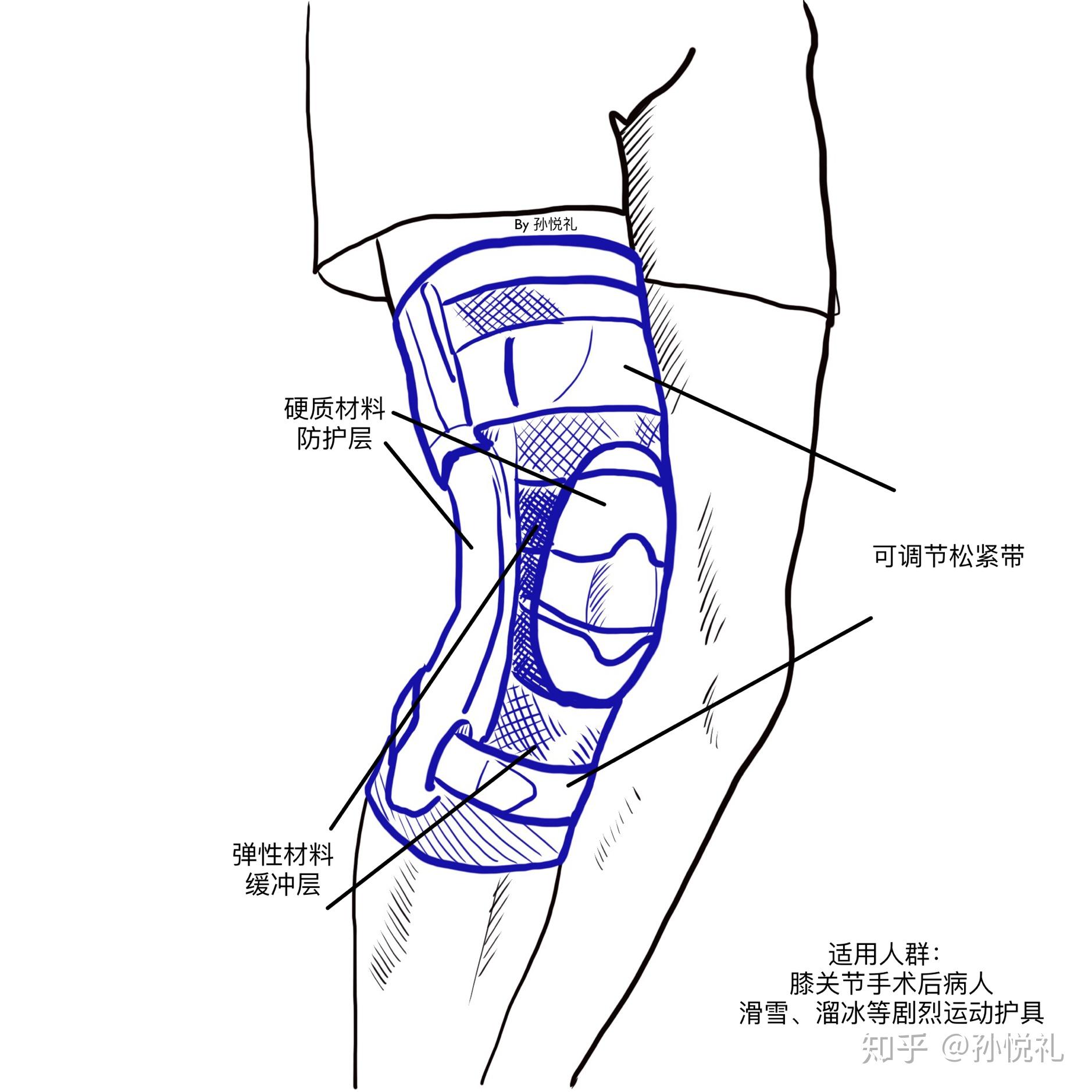 护膝的自制图解图片