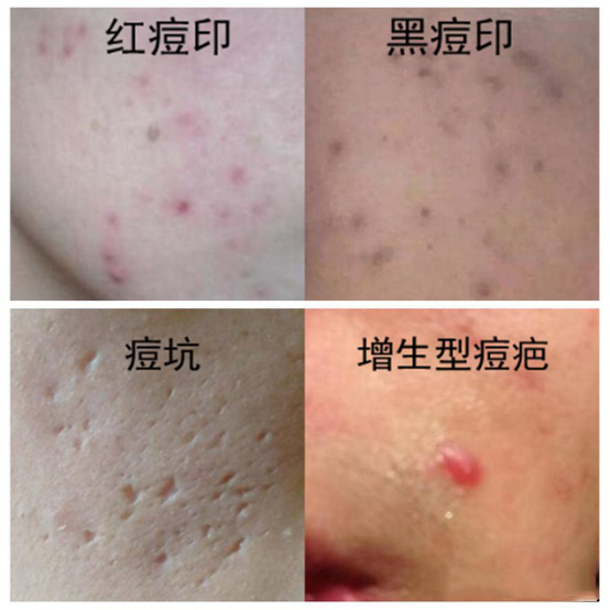 v2-716dea90d718100b3cc542a8b8eb20b9_r.jpg