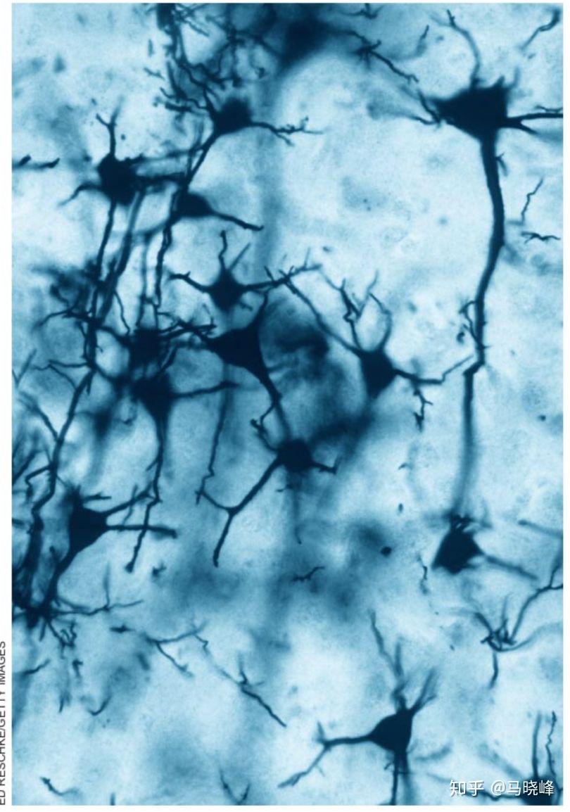 多极神经元he染色图片