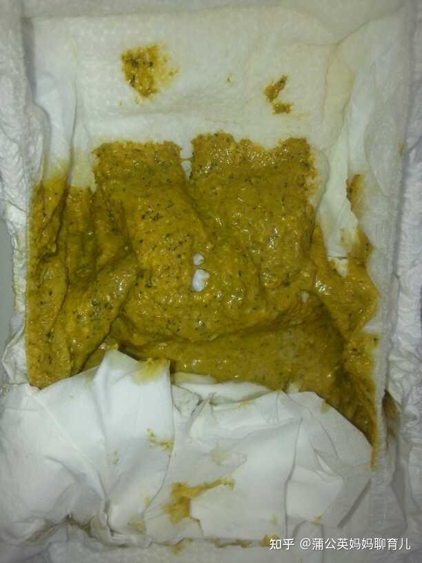 比如菠菜,就会导致大便出现绿色