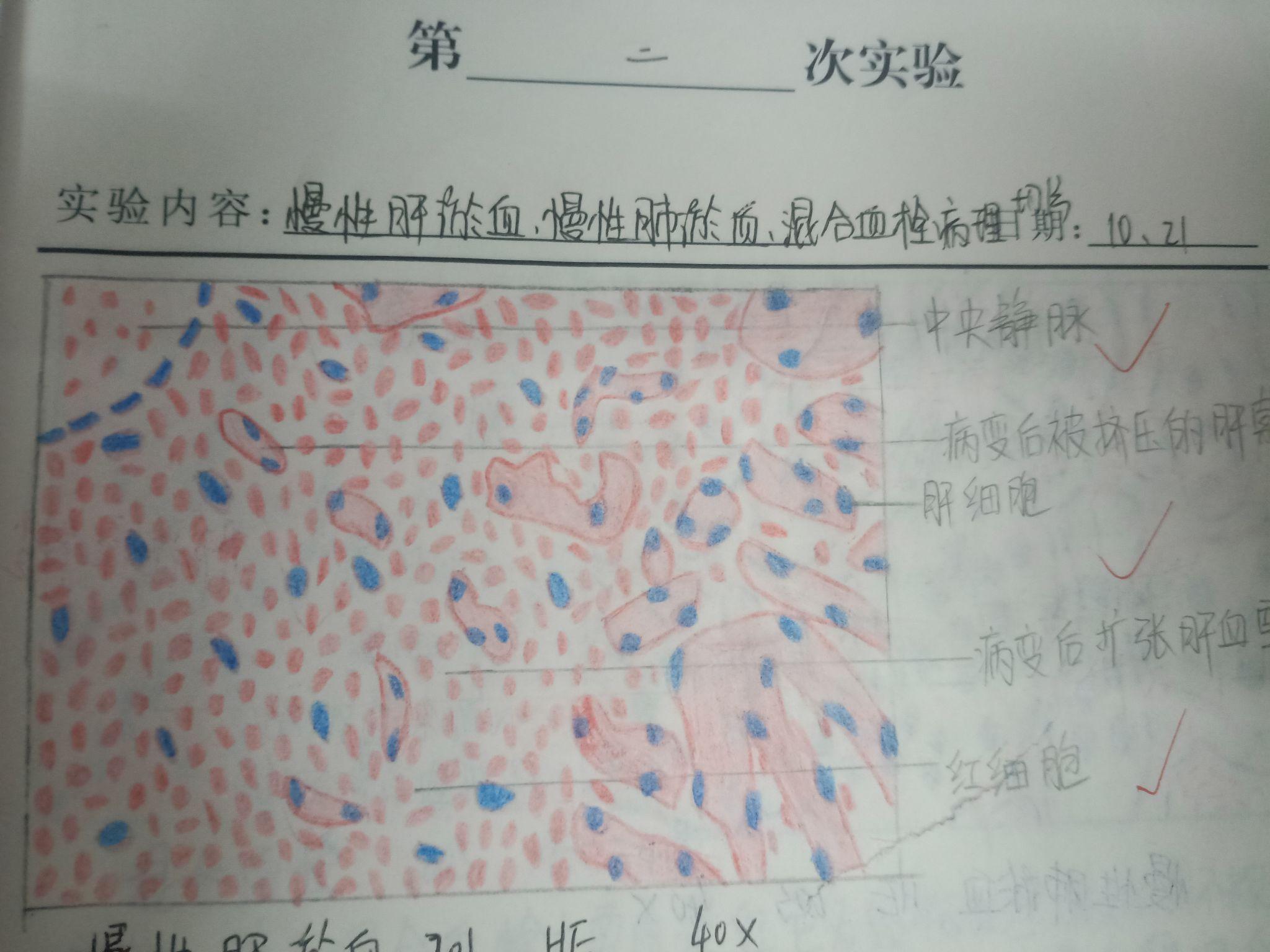 肉芽組織,肝細胞脂肪變,慢性肝淤血,慢性肺淤血,混合血栓,肝膿腫,各種