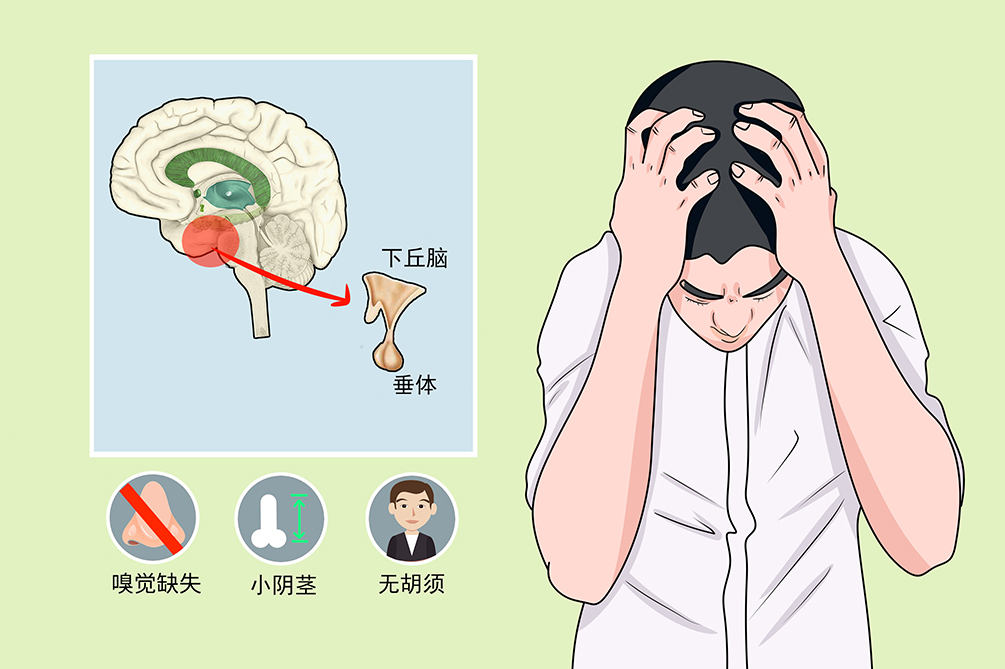 垂体功能减退症 zhuanlan.zhihu.com